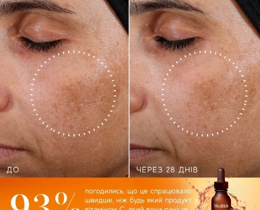 SUPER C FERULIC™