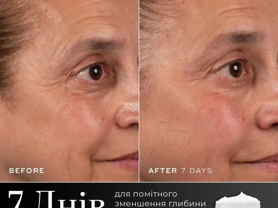 Lift Peptide Boost