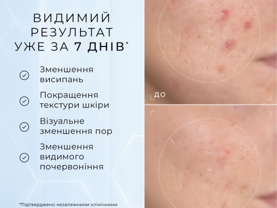 Niacinamide Peptides