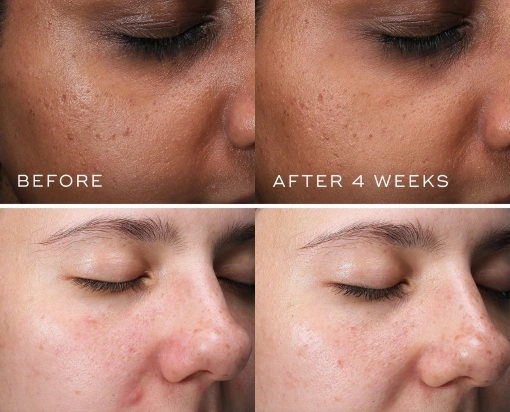 CLARITY PEPTIDES™