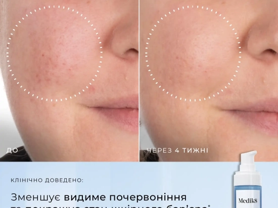Niacinamide Peptides