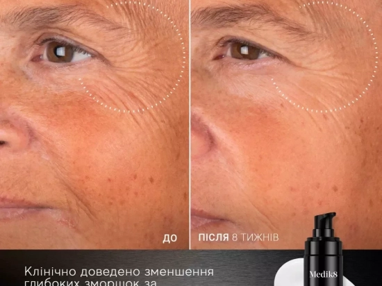 Lift Peptide Boost