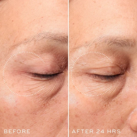 Опис CRYSTAL RETINAL® CERAMIDE EYE 5